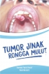 Tumor Jinak Rongga Mulut